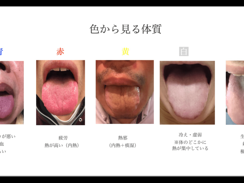 舌診断画像, 舌を診る時の注意点 , 舌診について – CTPLGD