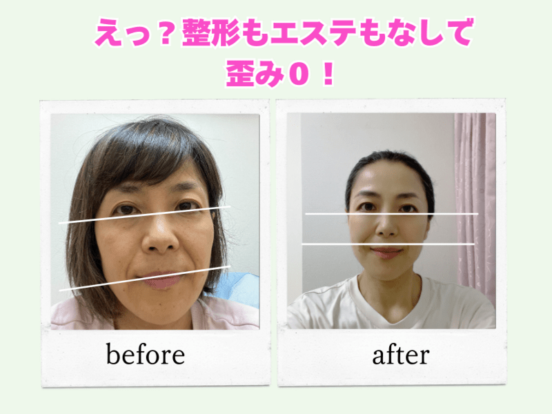 フェイスプレイヤー エステ 小顔矯正 美顔器 表情筋 リフトアップ フェイスケア 顔たるみ必見！】顔リフトアップ小顔矯正！オンラインでセルフケア