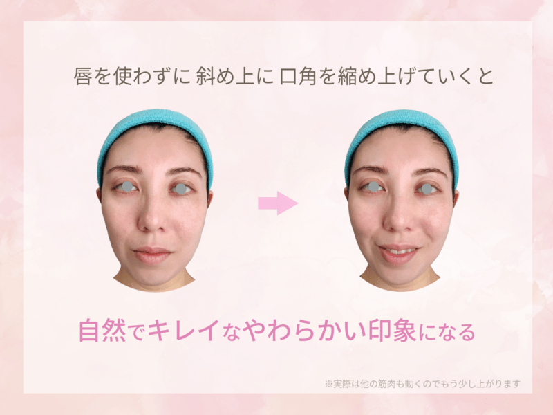 Making Smile: キレイな口元で素敵な笑顔になるために ぱにたん on X: 