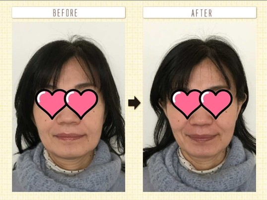 札幌の さとう式リンパケア セルフケア90分 By さとう かづな ストアカ