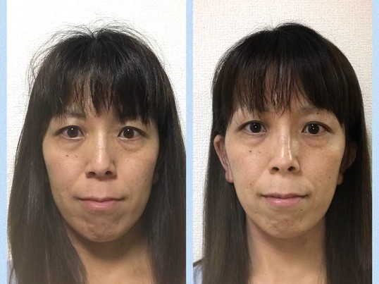 鴻巣 久喜の 管理栄養士によるファスティング講座 栄養学講座 試食付き By 田中 優紀 ストアカ