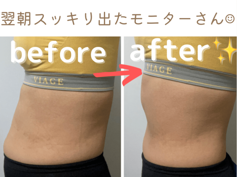 オンライン講座 寝たまま15分で便秘解消 即効性抜群 腸もみマッサージ By 美尻トレーナー なつ先生 ストアカ