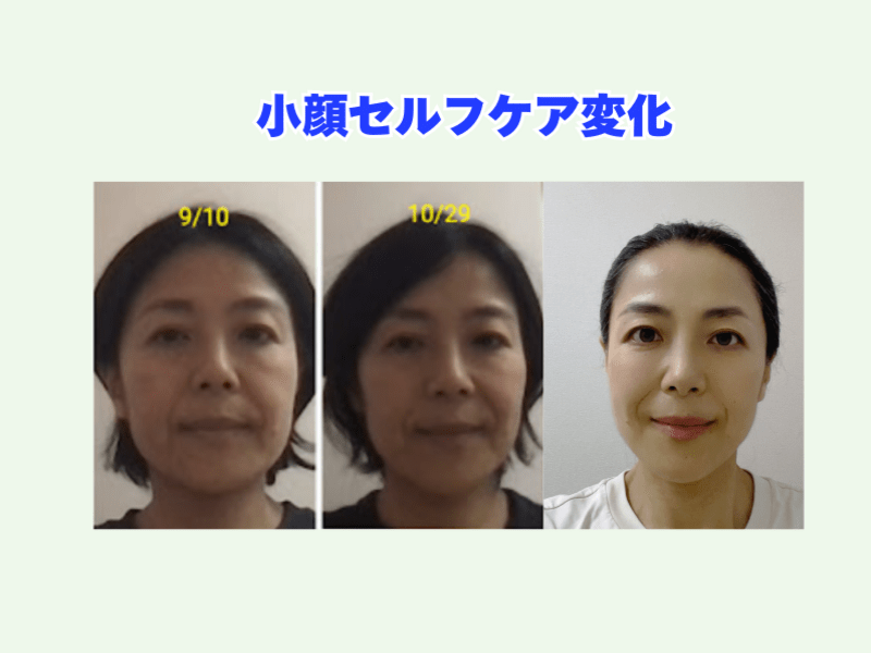 顔たるみ必見！】顔リフトアップ小顔矯正！オンラインでセルフケア