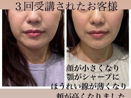 マンツーマン顔ヨガ*動画付き🥰表情筋を鍛え引き締まる💛小顔へ
