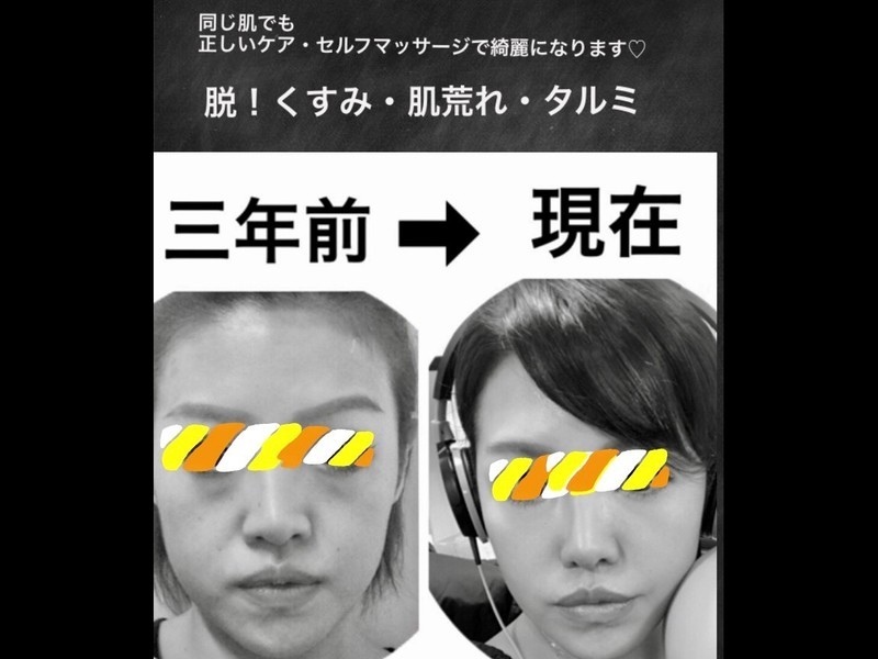 中洲 博多の セルフであなたの本来の美しさを取り戻す つるつる肌ケア By 佐々木 沙織 ストアカ
