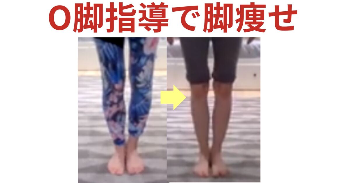 O脚矯正プログラム Amazon.co.jp: O脚の治し方、即効性ある簡単ストレッチ5分だけ O