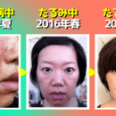 酒さの本当の原因は心にある!自分で改善できる!の講座の風景