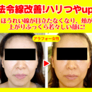 酒さの本当の原因は心にある!自分で改善できる!の講座の風景