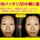 酒さの本当の原因は心にある!自分で改善できる!の講座の風景