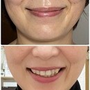 シワたるみ改善ー５歳！自分史上最高に魅力アップの講座の風景