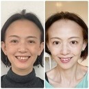 シワたるみ改善ー５歳！自分史上最高に魅力アップの講座の風景