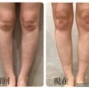 脱O脚へ。憧れ美脚を叶えるセラピスト講座の講座の風景