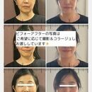 変われた！が嬉しい♪自信が持てる私になる習慣の講座の風景