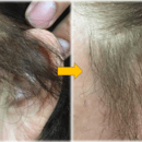 立毛筋・筋膜　ヘッドスパ講師　【体験無料】の講座の風景