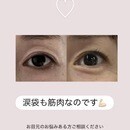 変化率95%！大人のための表情筋トレーニングの講座の風景