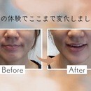 整形を迷う前に、“自力で変わる”という選択肢を。の講座の風景