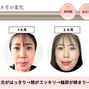 自分の理想の顔に近づける！アラフィフ表情筋トレ　の講座の風景