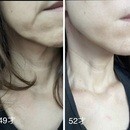  50代から始める−5歳印象セルフケアの講座の風景