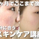 ニキビ、毛穴知らず！自分の肌と向き合う相談室の講座の風景